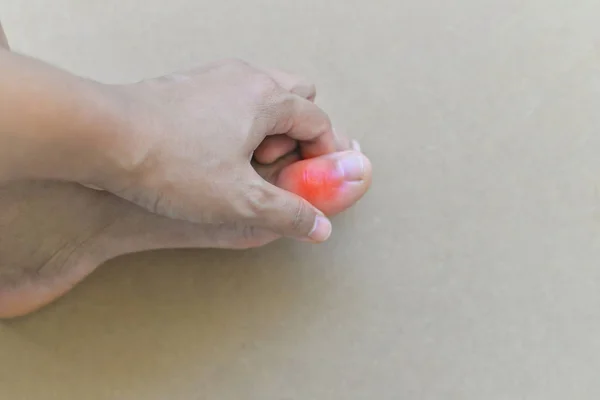 Ağrılı ve iltihaplı gut
