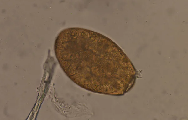 Ovo de parasita Fasciola tamanho grande . — Fotografia de Stock