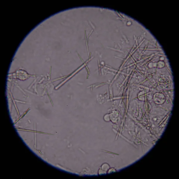 Умеренная форма иглы из мочевой кислоты — стоковое фото
