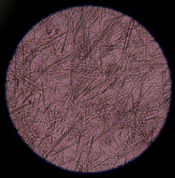 Måttlig urinsyra crystal nål form — Stockfoto