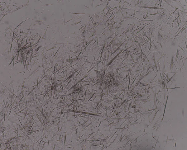 Orta Ürik asit kristal iğne şekli