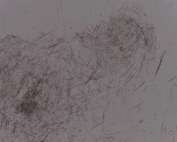 Orta Ürik asit kristal iğne şekli