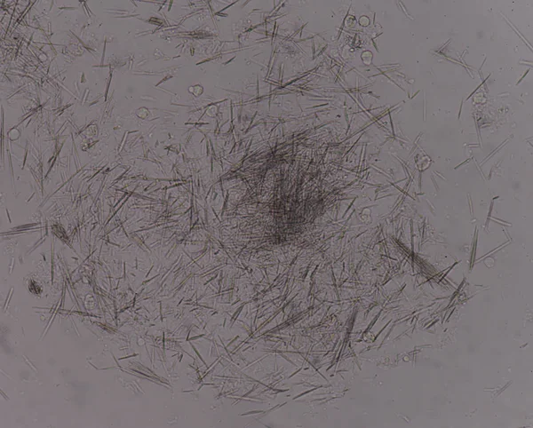 Orta Ürik asit kristal iğne şekli