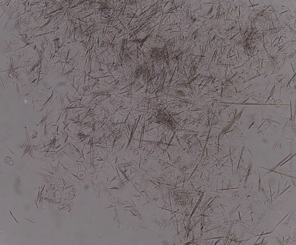 Orta Ürik asit kristal iğne şekli