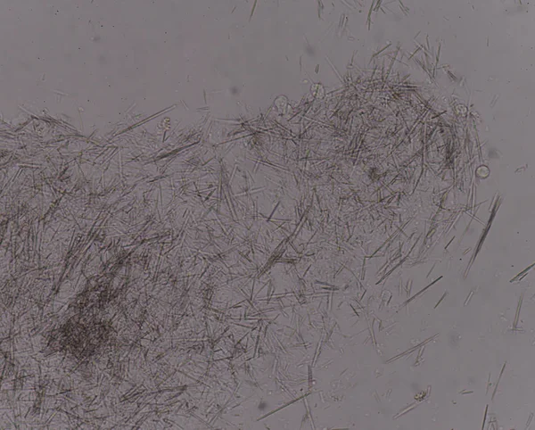 Orta Ürik asit kristal iğne şekli