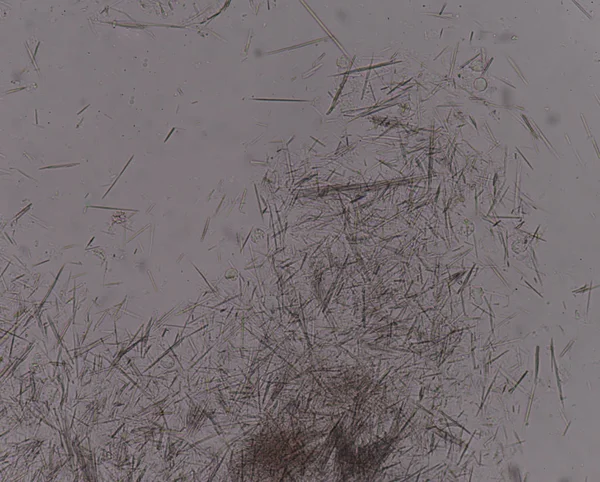 Orta Ürik asit kristal iğne şekli