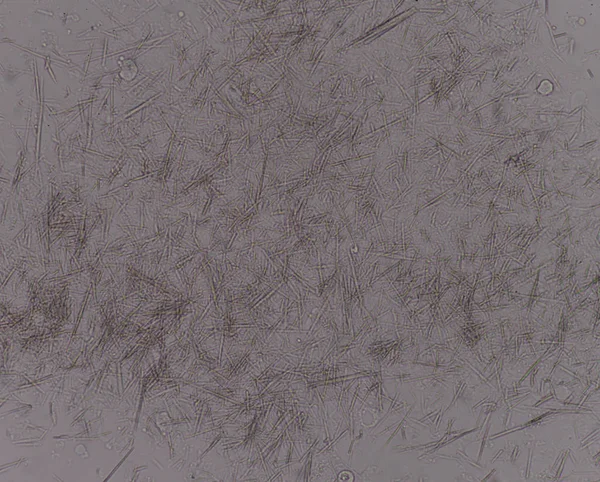 Orta Ürik asit kristal iğne şekli — Stok fotoğraf