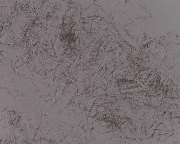 Orta Ürik asit kristal iğne şekli