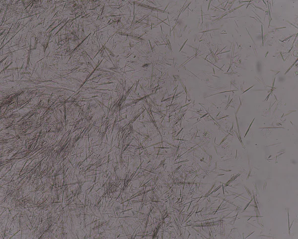 Orta Ürik asit kristal iğne şekli