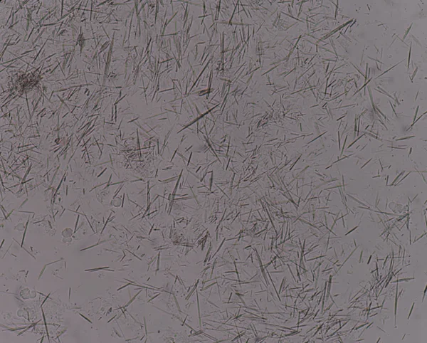 Orta Ürik asit kristal iğne şekli