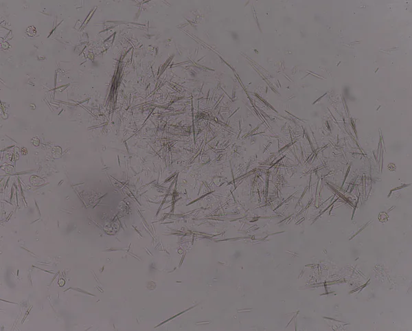 Orta Ürik asit kristal iğne şekli