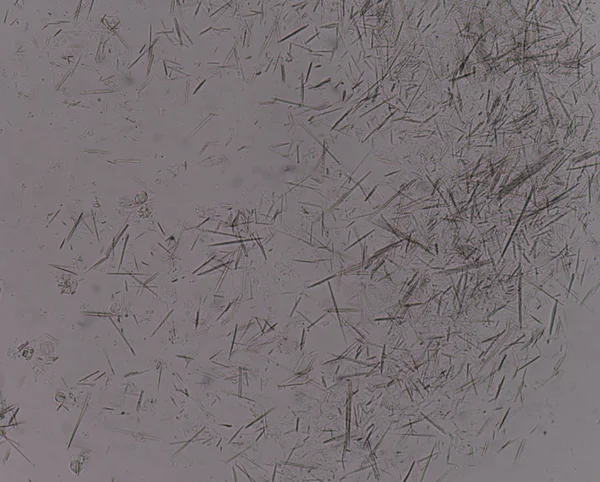 Orta Ürik asit kristal iğne şekli