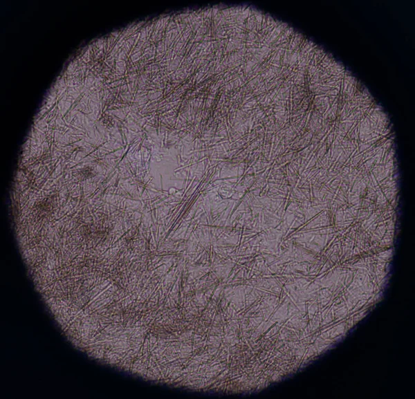 Orta Ürik asit kristal iğne şekli