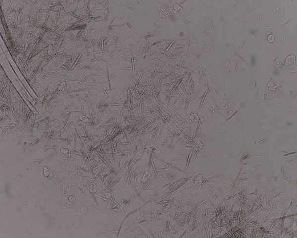 Orta Ürik asit kristal iğne şekli