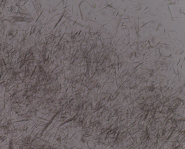 Orta Ürik asit kristal iğne şekli