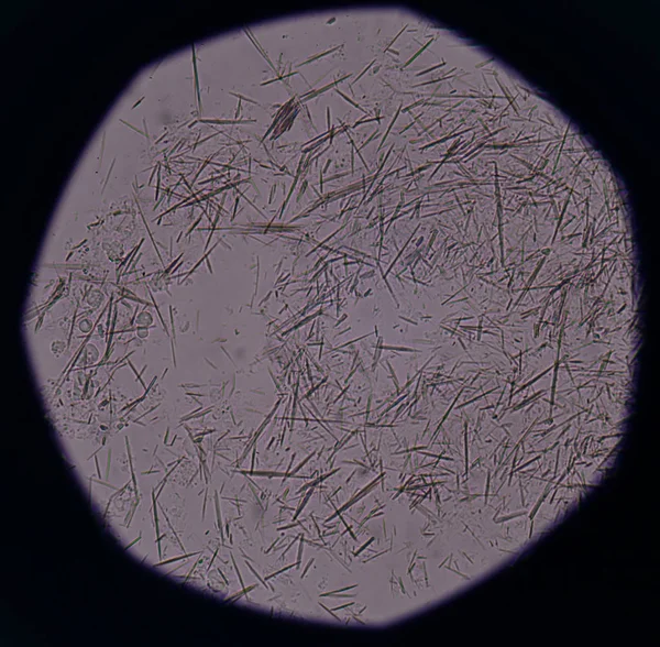 Orta Ürik asit kristal iğne şekli