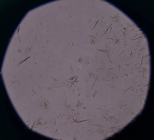 Orta Ürik asit kristal iğne şekli