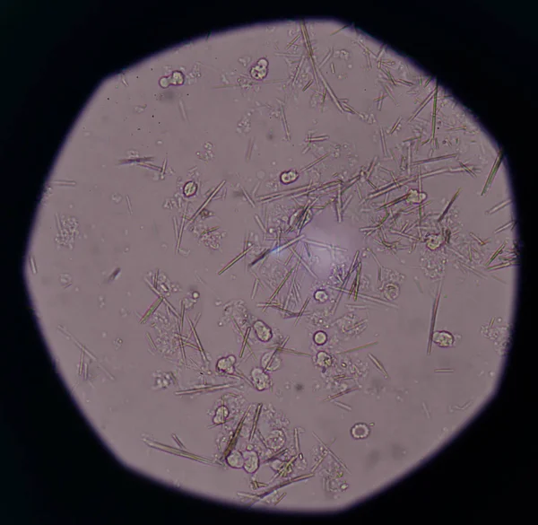 Orta Ürik asit kristal iğne şekli