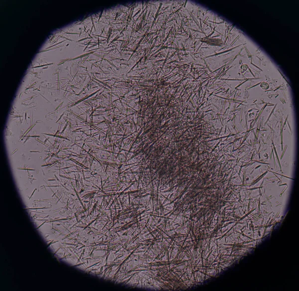 Orta Ürik asit kristal iğne şekli