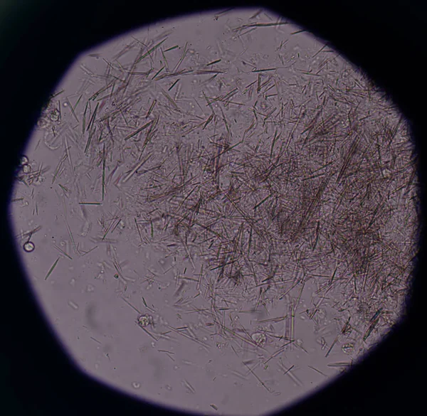 Orta Ürik asit kristal iğne şekli