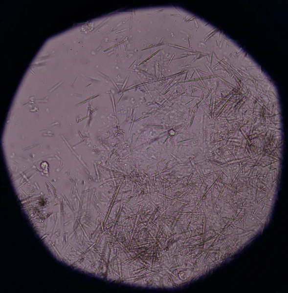 Orta Ürik asit kristal iğne şekli