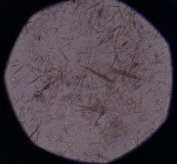 Måttlig urinsyra crystal nål form — Stockfoto