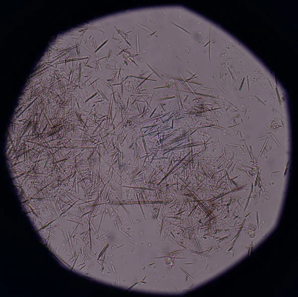 Matige urinezuur kristallen naald vorm — Stockfoto