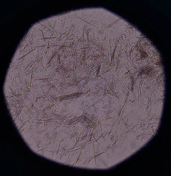 适度的尿酸晶体针形状 — 图库照片