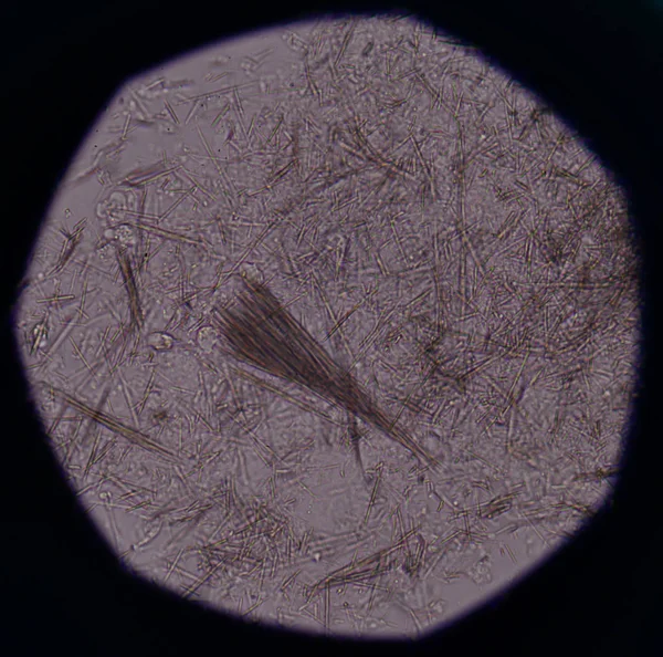 Orta Ürik asit kristal iğne şekli