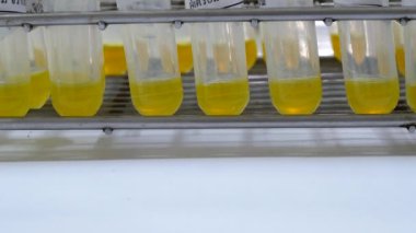 Kahverengi şişe reaktif laboratuvar kavramı kapatın.