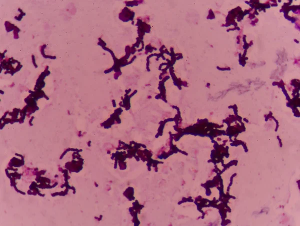 Gramm-Flecktest zeigt Bakterienzellen. — Stockfoto