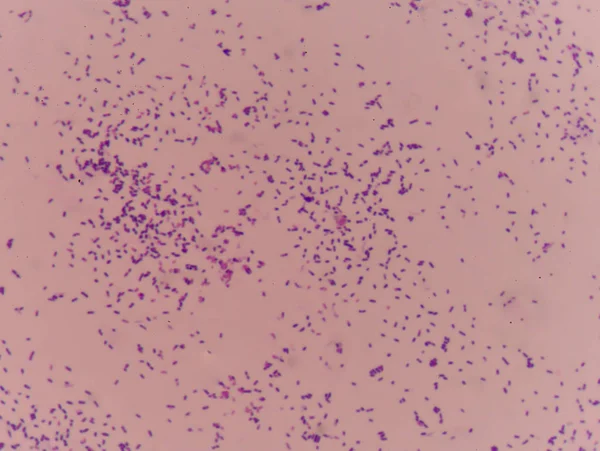 Gramm-Flecktest zeigt Bakterienzellen. — Stockfoto