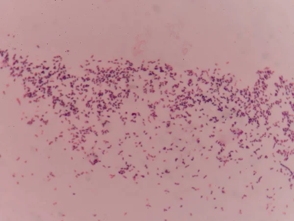 Prueba de tinción de gramo que muestra células bacterianas . — Foto de Stock