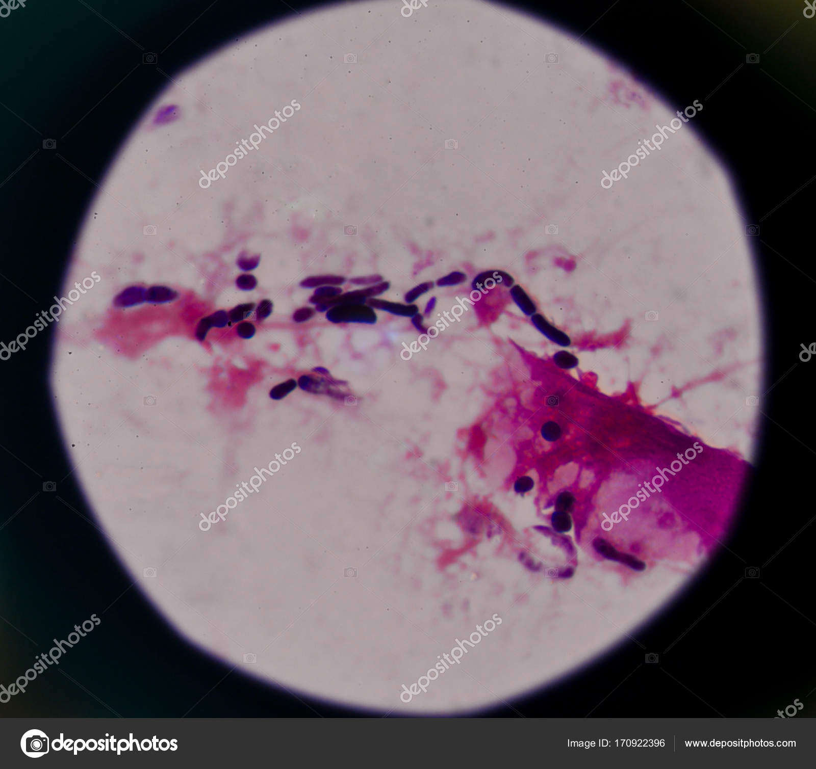 tincion de celulas epiteliales