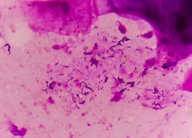 bakteri hücre gram leke yöntemi.