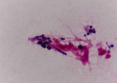 Maya hücre gram leke yöntemi içinde filizlenen.