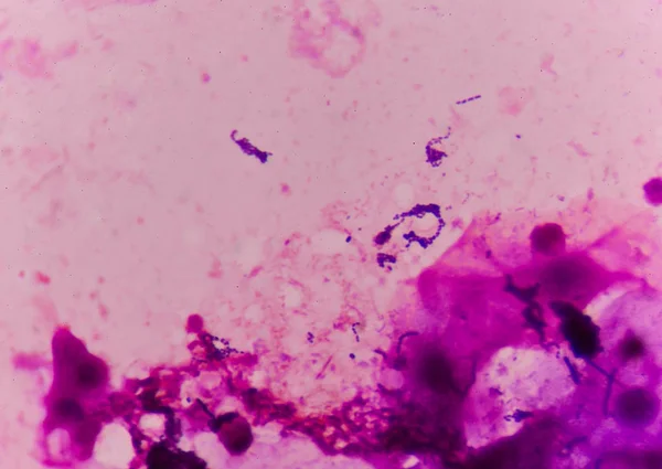 Célula bacteriana en método de tinción de gramo . — Foto de Stock