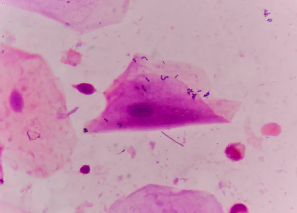 Buňka bakterie v Gramovo barvení metodou. — Stock fotografie