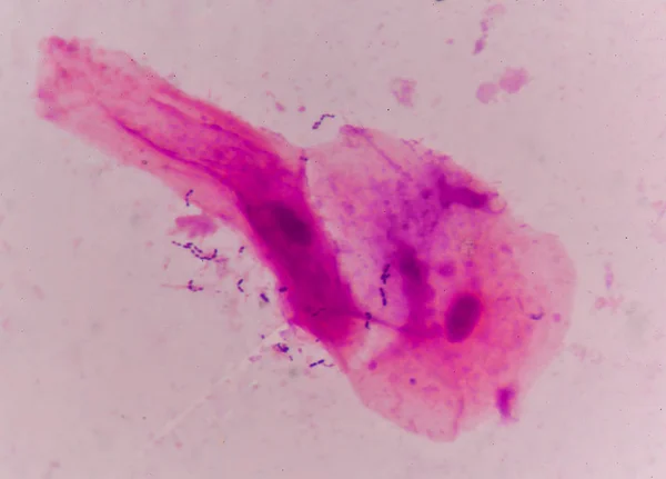 Célula bacteriana en método de tinción de gramo . —  Fotos de Stock