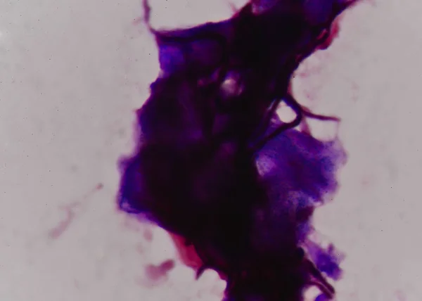 グラム染色法で酵母細胞を出芽. — ストック写真