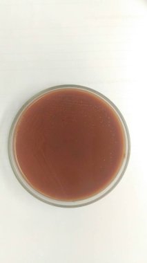 Agar plaka ve biyokimya testi kapatın.