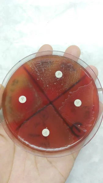 Close up agar plate and biochem test.