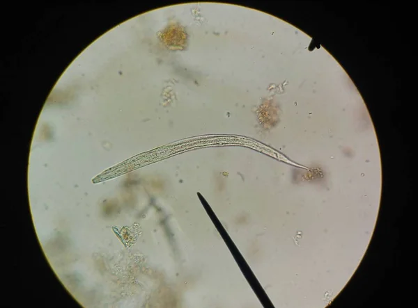 寄生虫の成虫と卵を閉じる. — ストック写真