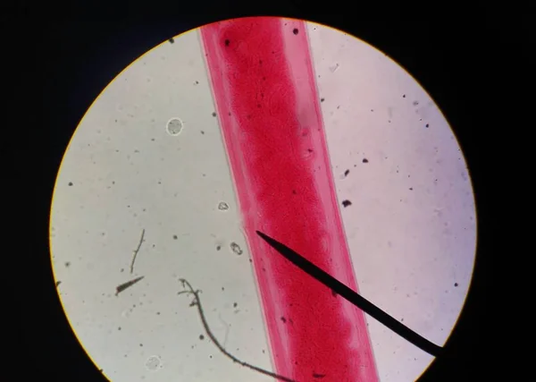 Detailní záběr vejce s dospělého parazita. — Stock fotografie
