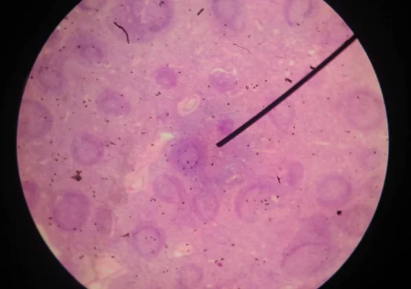 人間の細胞を顕微鏡で見つける. — ストック写真
