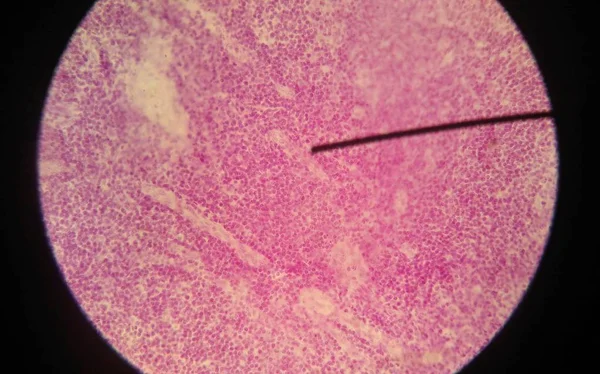 Células del hallazgo humano con microscopio . — Foto de Stock