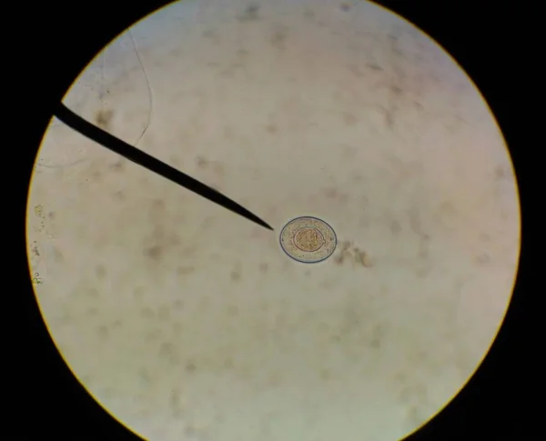 Close up ovo com adulto de parasita . — Fotografia de Stock