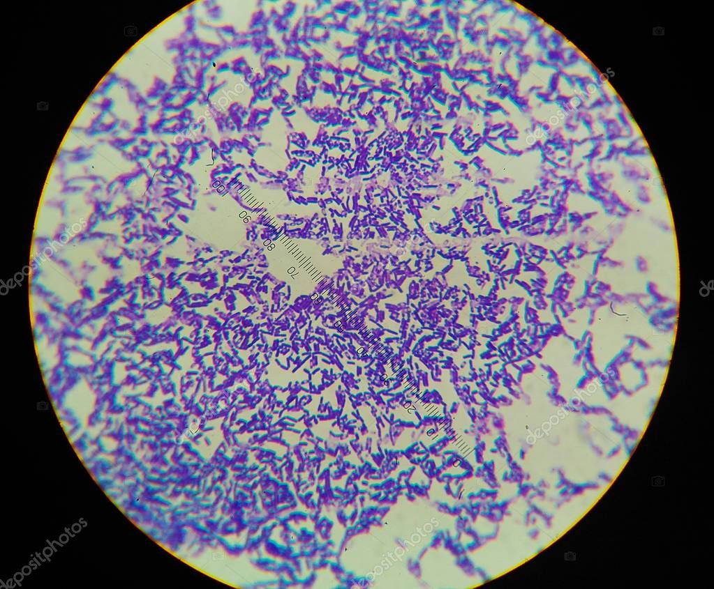 Bacilos gram positivos con spor formando — Foto de stock © toeytoey