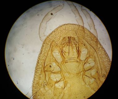 Makro hayvan parazit bulmak mikroskop ile.