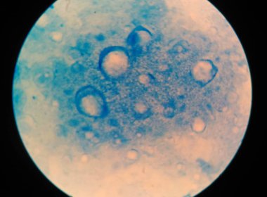 Asit hızlı basiller mavi üzerinde olumsuz.